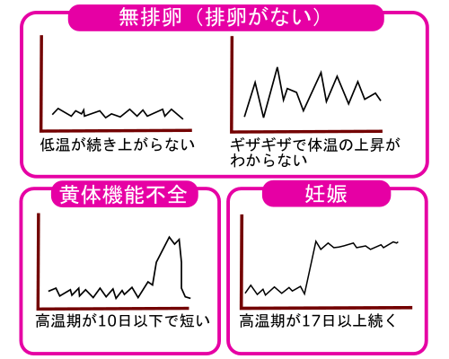 排卵がない場合のグラフ例