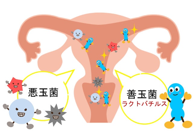 子宮内フローラ1-min