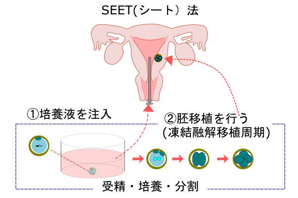 SEET法