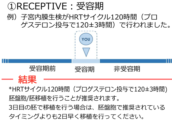 RECEPTIVEについて